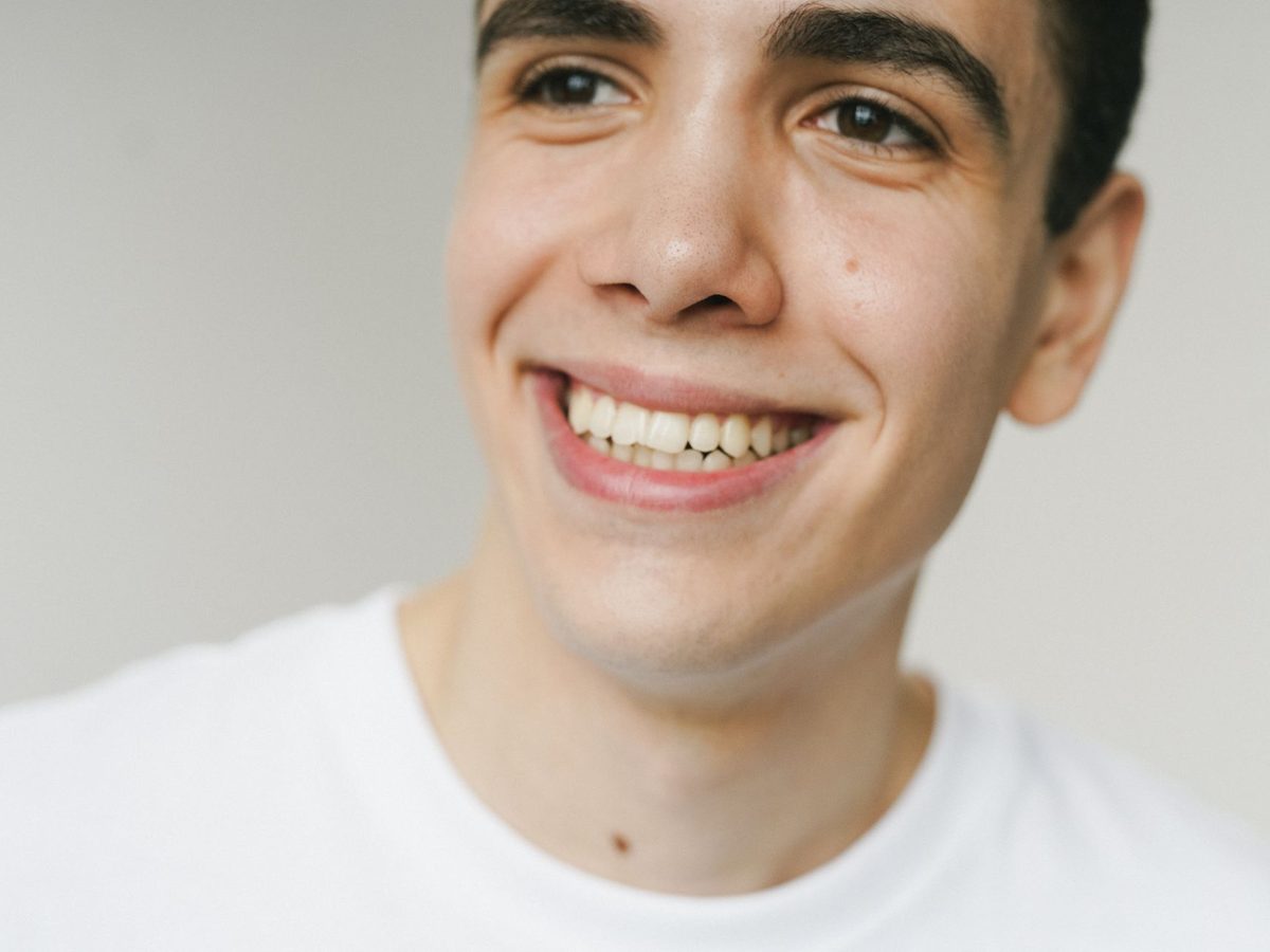 Dental bonding — smile result