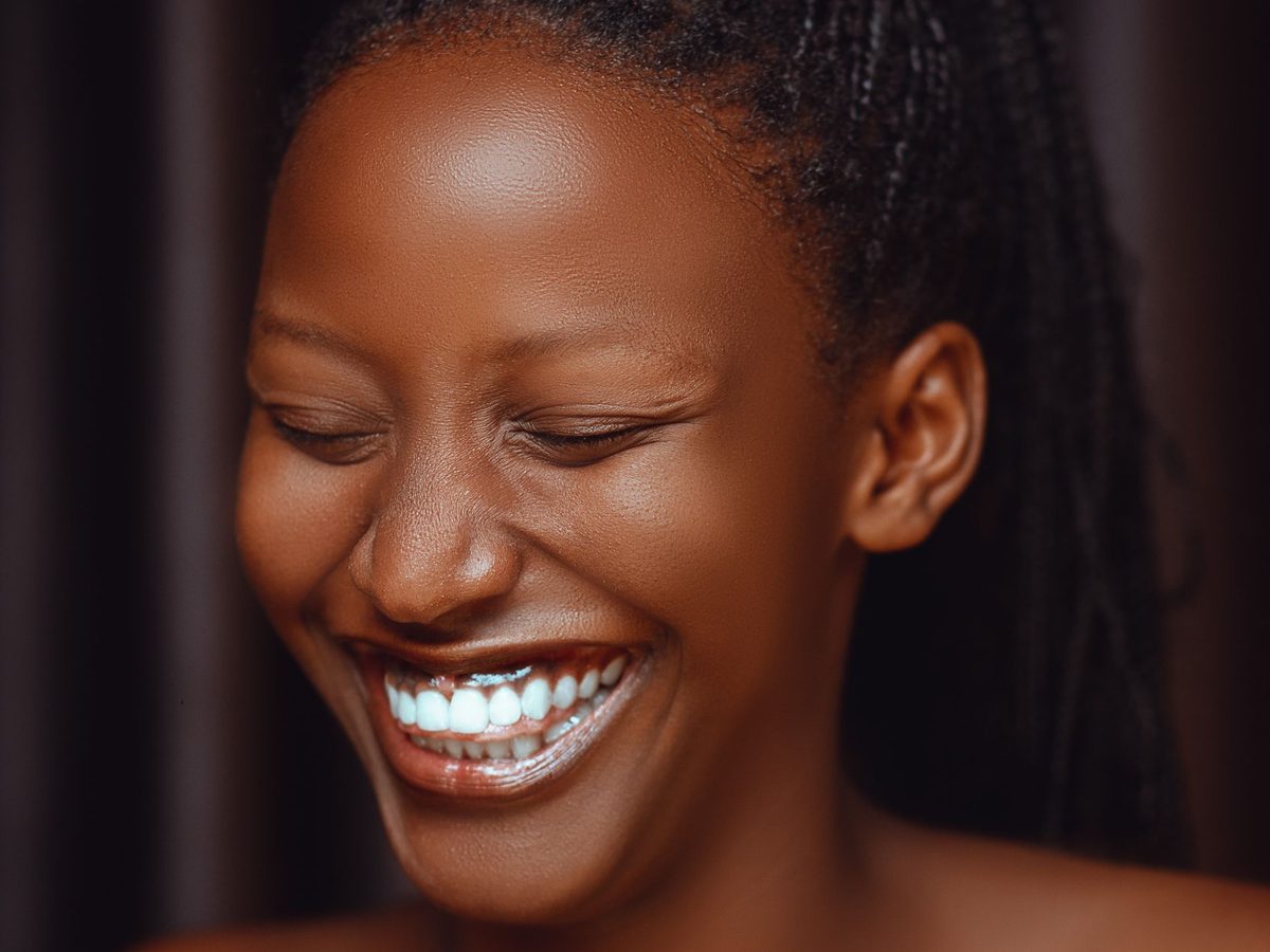Silver-to-white fillings — smile result