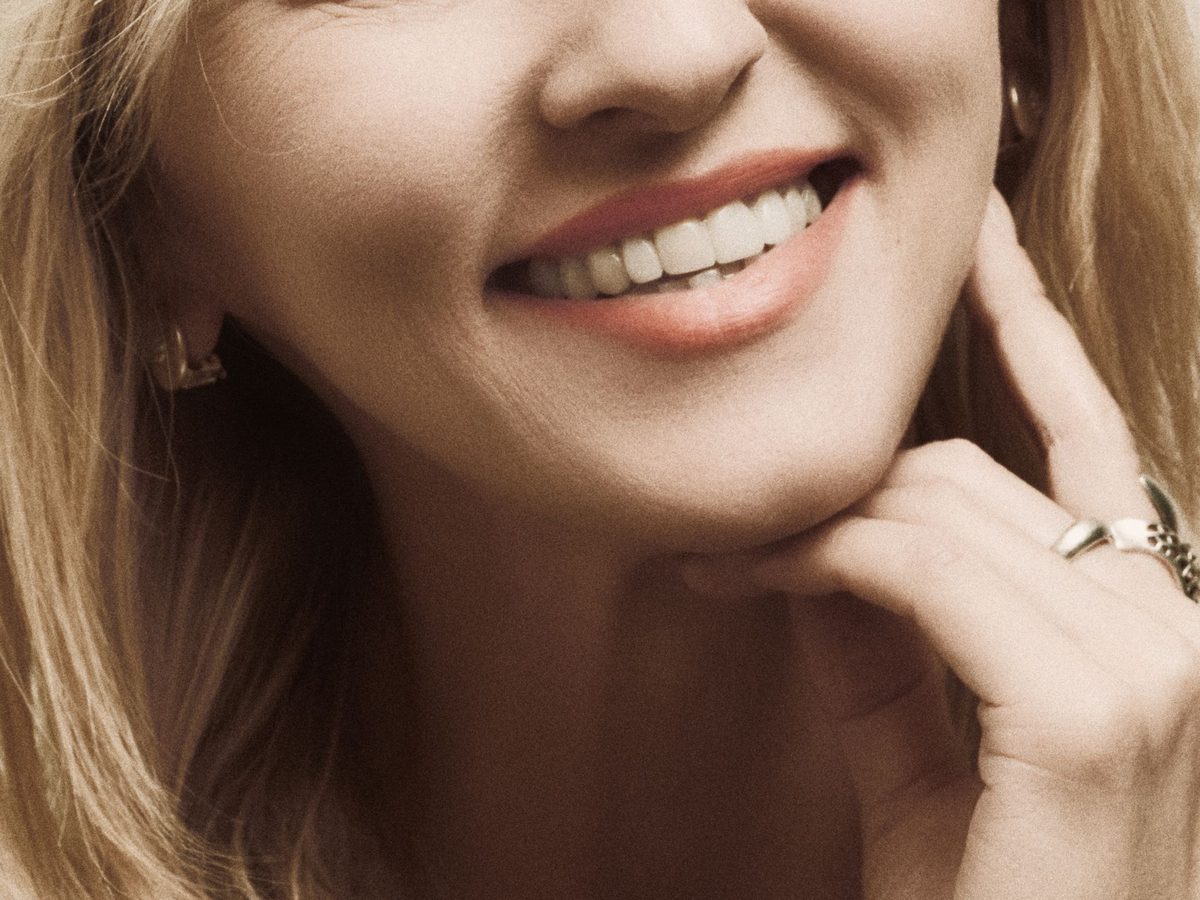 Porcelain veneers — smile result
