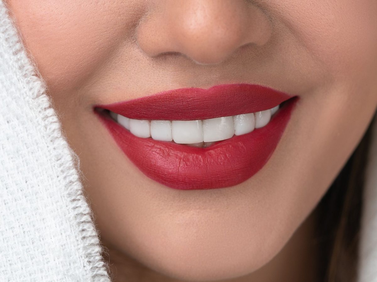 Porcelain veneers — smile result